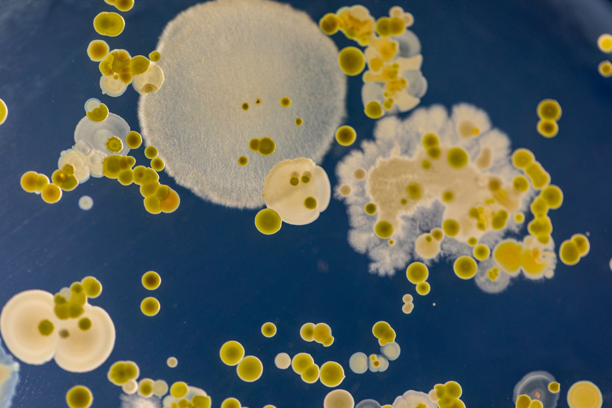 Mold samples viewed at high magnification to show details of mold vs mildew.